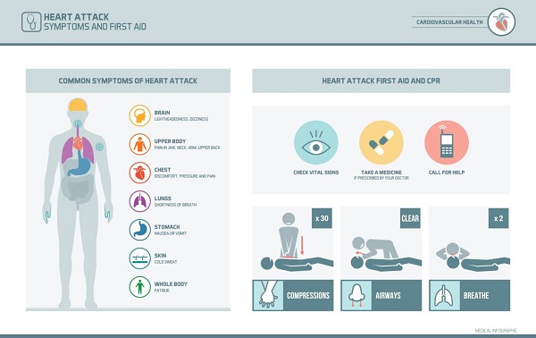 Heart Attack: Causes, Symptoms, and First Aid Explained